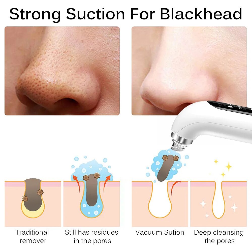 Blackhead Remover Vacuum Face Cleaner