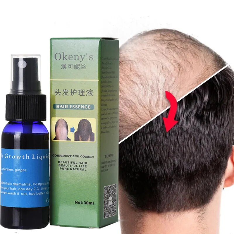 Hair Growth Essence Oil
